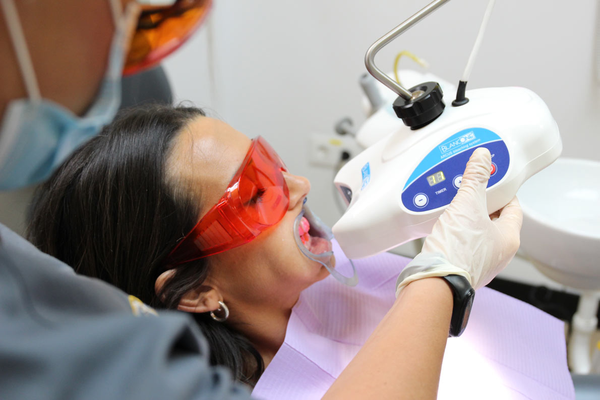 Cómo tener los dientes más blancos Zenit Odontólogos Jerez Blanqueamiento