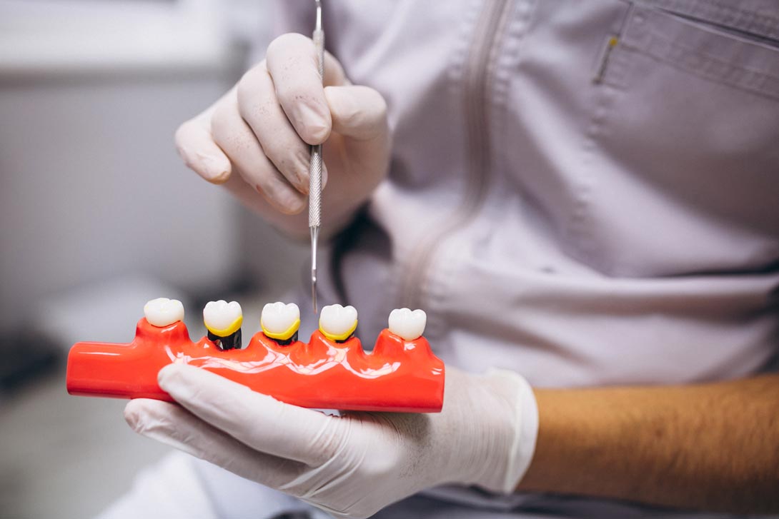 Piorrea: causas y tratamiento en Clínica Dental Zenit Odontólogos en Jerez de la Frontera, Cádiz