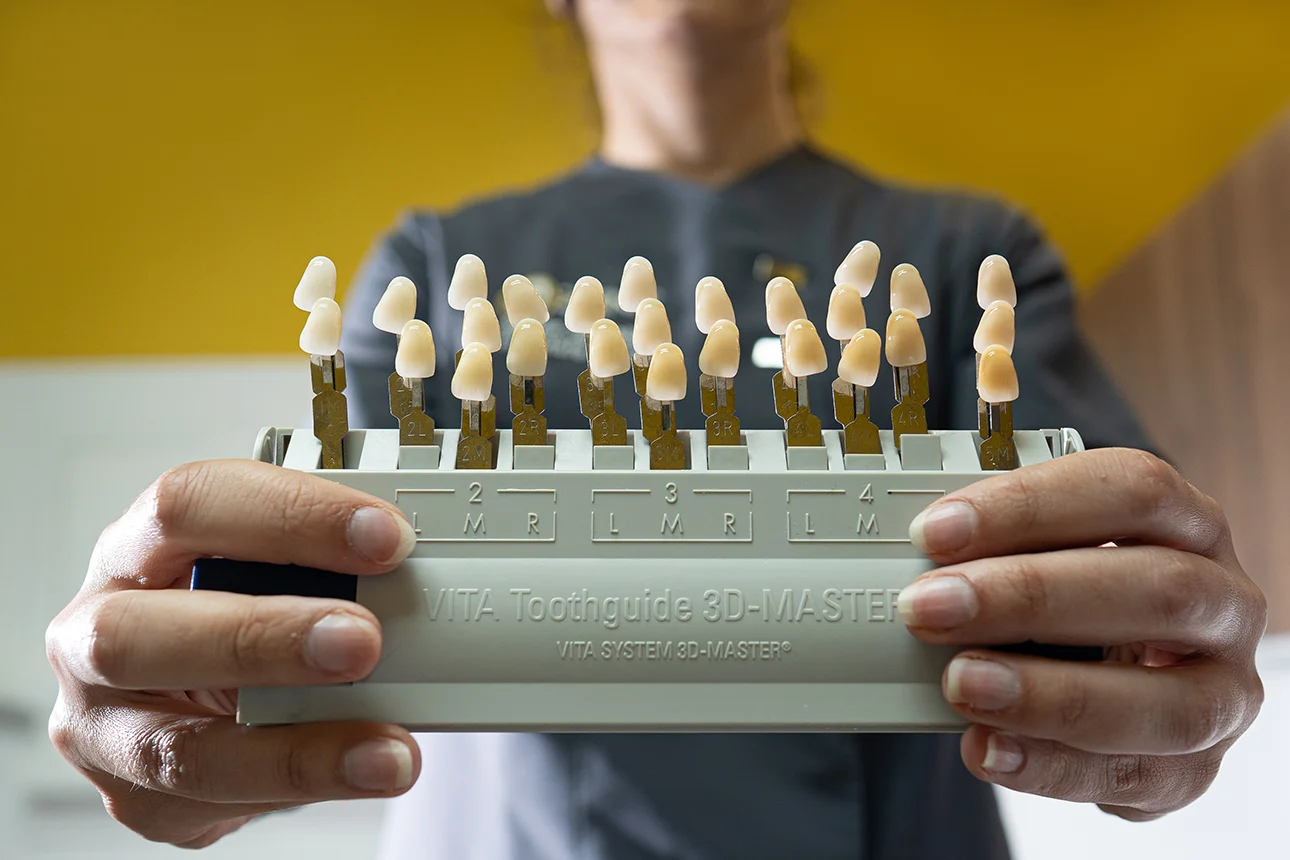 Estética Dental Blanqueamiento dental en Jerez de la Frontera Zenit Odontólogos