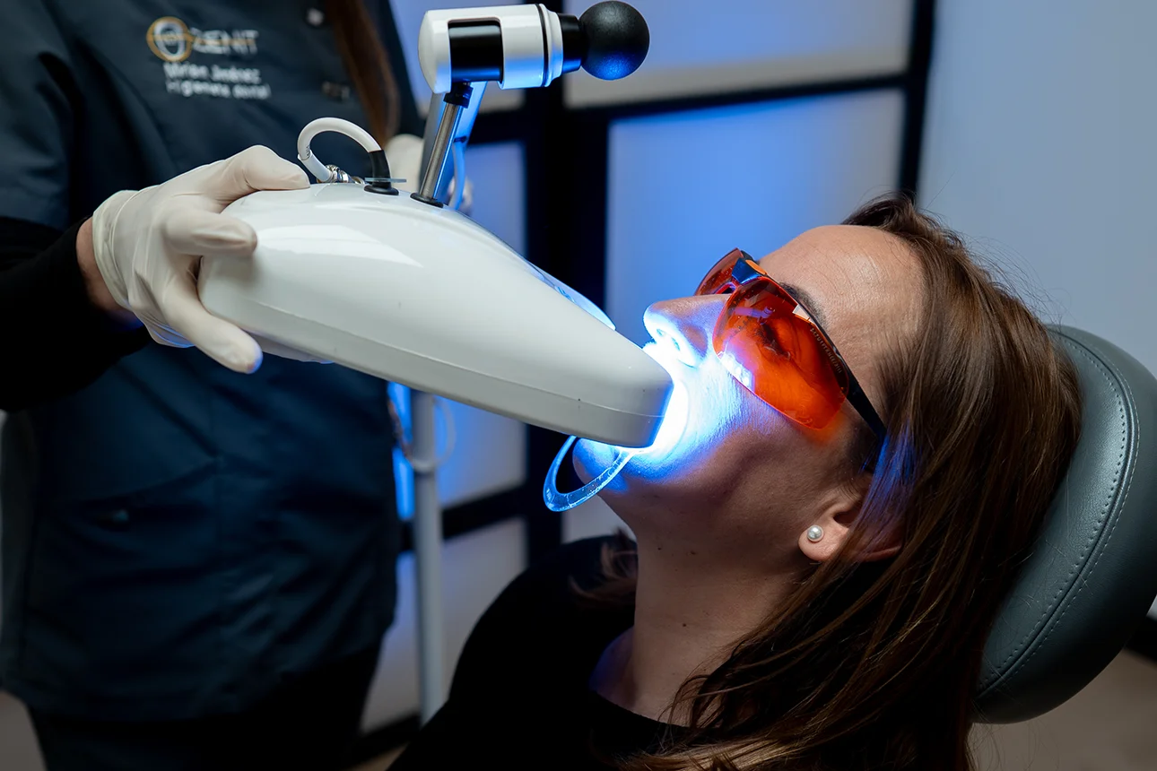 Estética Dental Blanqueamiento dental en clínica Jerez de la Frontera Zenit Odontólogos