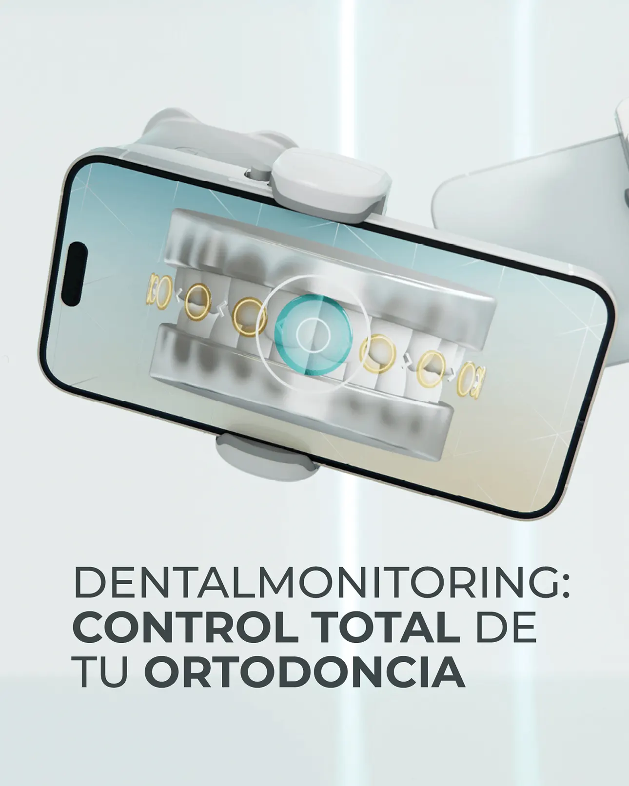 dental monitoring zenit ortodoncia 3D por IA